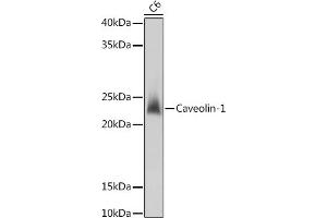Western blot analysis of extracts of C6 cells, using Caveolin-1 antibody (ABIN6131271, ABIN6137992, ABIN6137993 and ABIN6218615) at 1:1000 dilution. (Caveolin-1 anticorps  (AA 1-100))