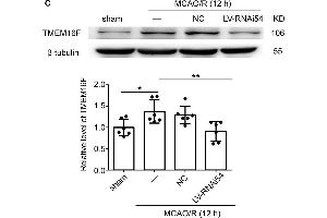 LV-TMEM16F-RNAi transfection downregulates TMEM16F in rat brain. (Anoctamin 6 anticorps  (AA 744-824))