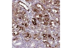 Immunohistochemical staining of human stomach, lower with C19orf47 polyclonal antibody  shows strong cytoplasmic positivity in glandular cells at 1:50-1:200 dilution. (C19orf47 anticorps)