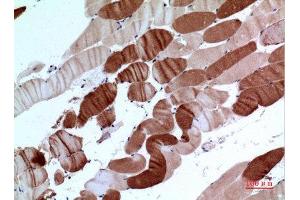 Immunohistochemistry (IHC) analysis of paraffin-embedded Human Muscle, antibody was diluted at 1:100. (ATP2A2 anticorps  (C-Term))