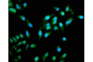 Immunofluorescence staining of Hela cells with ABIN7172247 at 1:333, counter-stained with DAPI. (TRAF6 anticorps  (AA 1-522))