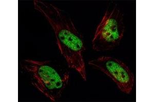 Fluorescent image of HeLa cells stained with SUMO antibody at 1:25. (SUMO1 anticorps  (AA 52-79))