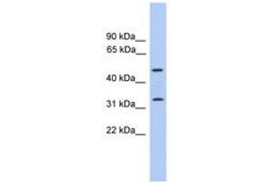 Image no. 1 for anti-Tumor Protein P63 Regulated 1 (TPRG1) (C-Term) antibody (ABIN6746427) (TPRG1 anticorps  (C-Term))