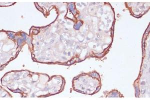 Immunohistochemistry of paraffin-embedded Human placenta using NT5E / CD73 Polyclonal Antibody at dilution of 1:200 (40x lens). (CD73 anticorps)