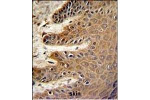 CDC37 Antibody (Center) (ABIN652914 and ABIN2842588) IHC analysis in formalin fixed and paraffin embedded skin followed by peroxidase conjugation of the secondary antibody and DAB staining.