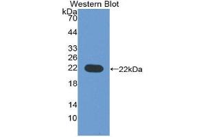 Western Blotting (WB) image for anti-CD276 (CD276) (AA 47-219) antibody (ABIN1867121) (CD276 anticorps  (AA 47-219))