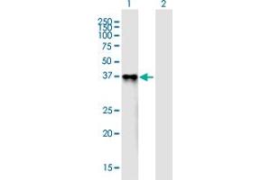 Western Blot analysis of PROL1 expression in transfected 293T cell line ( H00058503-T01 ) by PROL1 MaxPab polyclonal antibody. (PROL1 anticorps  (AA 1-248))