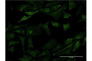 Immunofluorescence of monoclonal antibody to PML on HeLa cell. (PML anticorps  (AA 411-510))