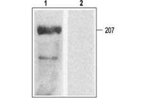 Western blot analysis of rat heart membranes:1.