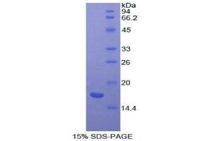 SDS-PAGE analysis of Cow ACVR2A Protein.