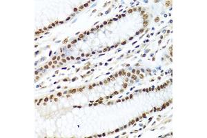Immunohistochemistry of paraffin-embedded human stomach using METTL3 antibody (ABIN5974672) at dilution of 1/100 (40x lens). (METTL3 anticorps)