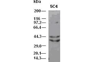DFF45 antibody (5C4) at 1:5000 dilution + Hela cell lysate (DFFA anticorps)