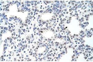 Immunohistochemical staining (Formalin-fixed paraffin-embedded sections) of human intestine with MCM6 polyclonal antibody . (MCM6 anticorps  (AA 771-820))