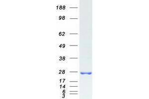 Validation with Western Blot
