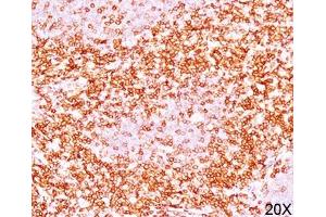 IHC testing of human tonsil (10X) stained with CD6 antibody (C6/372). (CD6 anticorps)