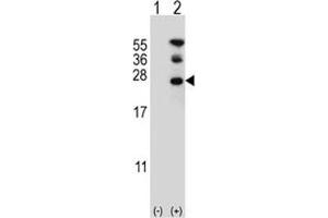Western blot analysis of RAN antibody and 293 cell lysate either nontransfected (Lane 1) or transiently transfected (2) with the RAN gene. (RAN anticorps  (AA 12-39))