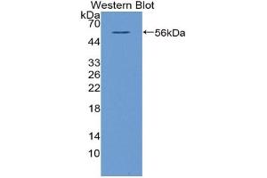 Detection of Recombinant NT5E, Bovine using Polyclonal Antibody to Cluster Of Differentiation 73 (CD73) (CD73 anticorps  (AA 48-527))