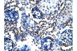 Human kidney (BAX anticorps  (N-Term))