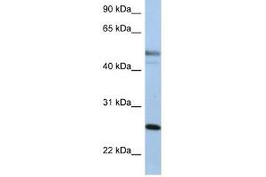 Cytokeratin 8 antibody used at 1 ug/ml to detect target protein. (KRT8 anticorps  (Middle Region))