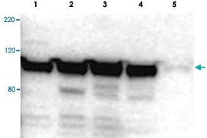 Western blot using MYO1G polyclonal antibody  shows detection of a band ~100 kDa in size corresponding to MYO1G (arrowhead) in MYO1G positive whole cell lysate. (MYO1G anticorps  (Internal Region))