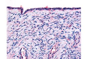 Anti-THRA antibody IHC of human surface epithelium. (THRA anticorps  (Ligand Binding Domain))