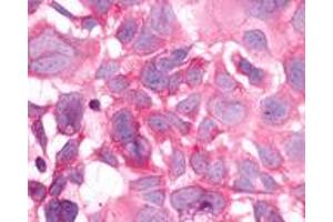 Anti-HRH3 / Histamine H3 Receptor antibody immunocytochemistry (ICC) staining of HEK293 human embryonic kidney cells transfected with HRH3 / Histamine H3 Receptor. (HRH3 anticorps  (Cytoplasmic Domain))