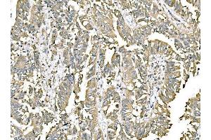 IHC analysis of ERp57 using anti-ERp57 antibody (ABIN7602778). (PDIA3 anticorps  (C-Term))