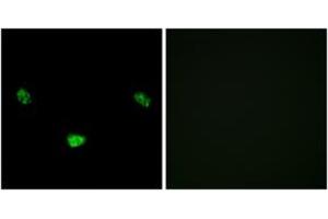 Immunofluorescence analysis of LOVO cells, using HNF4 alpha (Phospho-Ser313) Antibody.