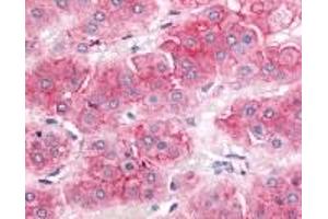 Immunohistochemistry (IHC) image for anti-ATP-Binding Cassette, Sub-Family B (MDR/TAP), Member 1 (ABCB1) (Cytoplasmic Domain) antibody (ABIN2469530)