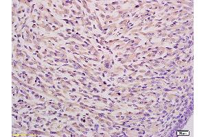 Formalin-fixed and paraffin embedded mouse embryo tissue labeled with Anti CKAP4 Polyclonal Antibody,Unconjugated (ABIN717506) at 1:200 followed by conjugation to the secondary antibody and DAB staining.
