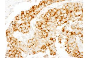 Immunohistochemistry (IHC) image for anti-Cytoskeleton-Associated Protein 4 (CKAP4) (AA 500-550) antibody (ABIN7454811)