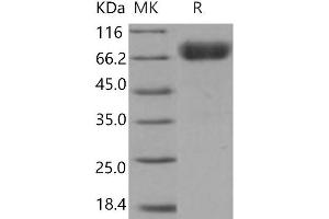 Western Blotting (WB) image for Hepatitis A Virus Cellular Receptor 1 (HAVCR1) protein (His tag,Fc Tag) (ABIN7320315)