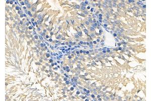 ABIN6264759 and ABIN6278629 at 1/100 staining Rat testis tissue by IHC-P.