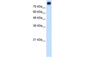 Western Blotting (WB) image for anti-P-Cadherin (CDH3) antibody (ABIN2462833) (P-Cadherin anticorps)