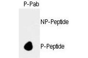 Dot blot analysis of anti-hRb- Phospho-specific Pab (ABIN389645 and ABIN2839637) on nitrocellulose membrane. (Retinoblastoma 1 anticorps  (pSer788))
