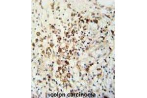 Immunohistochemistry (IHC) image for anti-HAUS Augmin-Like Complex, Subunit 5 (HAUS5) antibody (ABIN3002272) (HAUS5 anticorps)