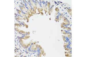 Immunohistochemistry of paraffin-embedded mouse lung using AMBRA1 antibody.