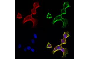 ABIN6262995 and ABIN6272963 staining Hela cells by IF/ICC. (LONP1 anticorps  (C-Term))