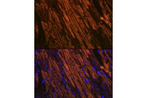 Immunofluorescence analysis of mouse heart using Cardiac Cardiac troponin T (TNNT2) (TNNT2) Rabbit mAb (ABIN7266088) at dilution of 1:100 (40x lens). (Cardiac Troponin T2 anticorps)