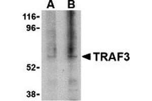Western Blotting (WB) image for anti-TNF Receptor-Associated Factor 3 (TRAF3) (C-Term) antibody (ABIN1030765) (TRAF3 anticorps  (C-Term))