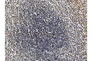 IHC analysis of RRS1 using anti-RRS1 antibody (ABIN7601344).