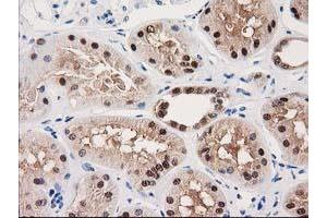 Image no. 4 for anti-UDP-Galactose-4-Epimerase (GALE) antibody (ABIN1498366) (GALE anticorps)