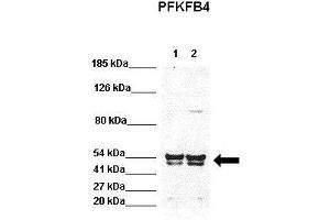WB Suggested Anti-PFKFB4 Antibody  Positive Control: Lane 1:441 µg HEK293 lysate Lane 2: 041 µg H1299 lysate Primary Antibody Dilution: 1:0000Secondary Antibody: Goat anti-rabbit-HRP Secondry  Antibody Dilution: 1:0000Submitted by: Jose Luis Rosa, Universitat de Barcelona (PFKFB4 anticorps  (N-Term))