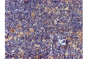 Image no. 7 for anti-NADH Dehydrogenase (Ubiquinone) Complex I, Assembly Factor 7 (NDUFAF7) antibody (ABIN1499667) (NDUFAF7 anticorps)