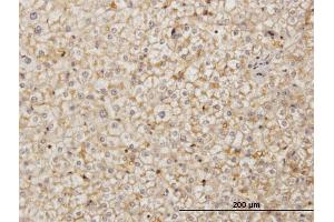 Immunoperoxidase of monoclonal antibody to SDF2 on formalin-fixed paraffin-embedded human liver.