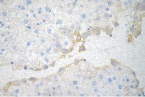 Immunohistochemistry was performed on paraffin-embedded mouse liver using acyl-CoA dehydrogenase short chain antibody (ABIN7797493), 1:200). (Recombinant Acyl Co-A Dehydrogenase (AIDB) (chain short) anticorps)