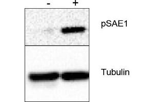 Image no. 1 for anti-SUMO1 Activating Enzyme Subunit 1 (SAE1) (Ser185) antibody (ABIN401467)