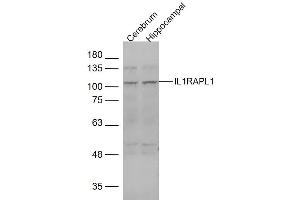 Lane 1: mouse cerebrum Lane 2: mouse hippocampal lysates probed with IL1RAPL1 Polyclonal Antibody, Unconjugated  at 1:1000 dilution and 4˚C overnight incubation. (IL1RAPL1 anticorps  (AA 301-400))