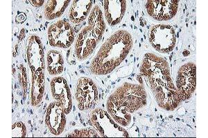 Immunohistochemical staining of paraffin-embedded Human Kidney tissue using anti-NUDT9 mouse monoclonal antibody. (NUDT9 anticorps)