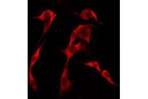 ABIN6276251 staining Hela by IF/ICC. (OR51F1 anticorps)